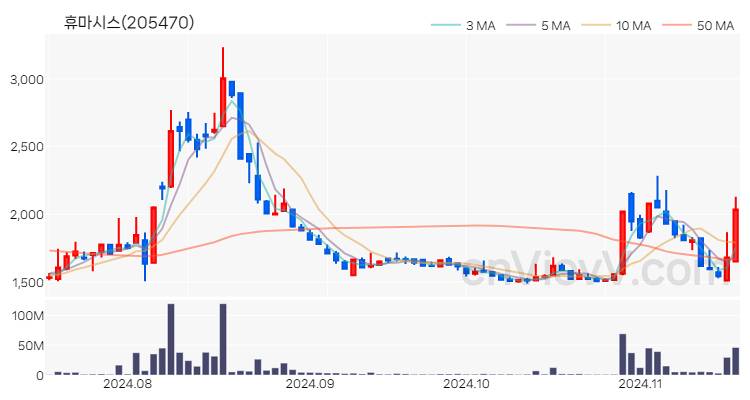 휴마시스 주가 핵심 요약 분석과 주식 차트 2024.11.18